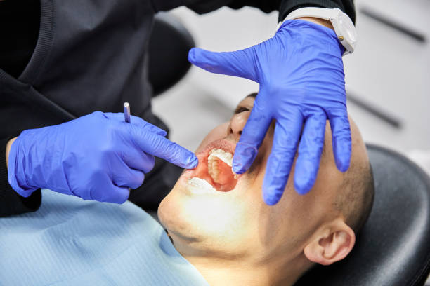 Best Knocked-Out Tooth (Avulsed Tooth) Treatment in Emory, TX