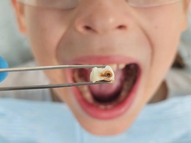 Best Walk-In Emergency Dental Services in Emory, TX